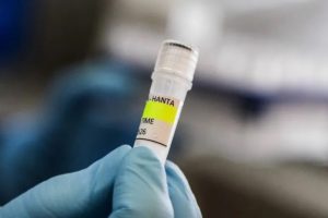تعرف على أعراض فيروس هانتا: كيف تنتقل العدوى وما الموصى به علمياً للوقاية