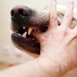 عضة الكلب .. 3 أخطاء يجب تجنبها وخطوات إسعافية قد تنقذ الحياة من داء السعار